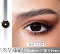 IRIS Open Lens Us Vision for Damage eye